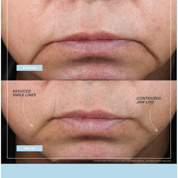 Nuface Mini+ Petite Facial Toning Device Microcurrent Skincare in Sandy Rose - Picture 7 of 10